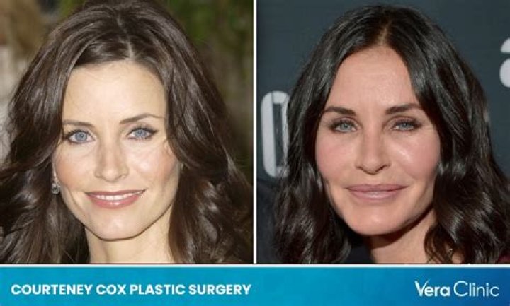 Courteney Cox Plastic Surgery: Did Breast Augmentation Play a Role in Her Figure?