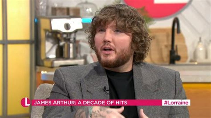 James Arthur Plastic Surgery: James's open admission to overcome childhood struggles!